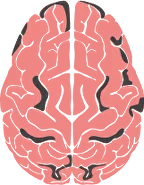 Cortical-subcortical dementia