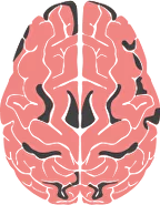 Multifocal dementia